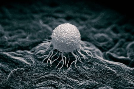 Photo for Cancer cell, illustration. Cancerous (malignant) cells divide rapidly and uncontrollably and are able to invade and destroy surrounding tissue. - Royalty Free Image