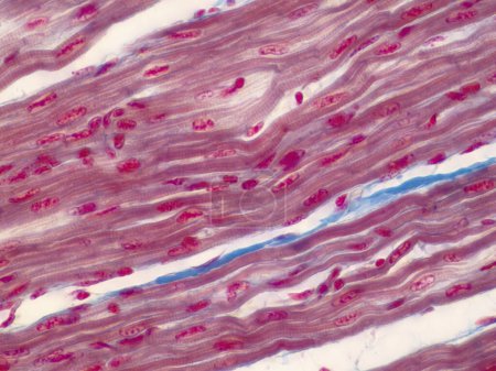 Photo for Human cardiac muscle, light micrograph. - Royalty Free Image