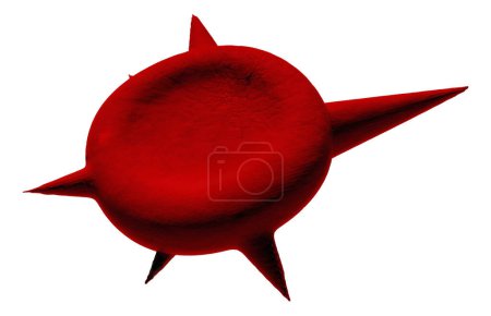 Foto de Ilustración de un glóbulo rojo anormal (eritrolindo) conocido como una célula del espolón, o acantocito. Los glóbulos rojos con esta apariencia pueden ocurrir en asociación con una afección rara llamada abetalipoproteinemia.. - Imagen libre de derechos