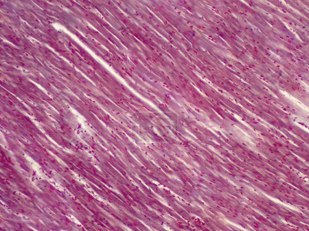 Foto de Músculo cardíaco humano, micrografía ligera. - Imagen libre de derechos