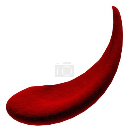 Photo for Illustration of a red blood cell (erythrocyte) affected by sickle cell anaemia. Sickle cell anaemia is an inherited blood disease in which the red blood cells contain an abnormal form of haemoglobin. - Royalty Free Image