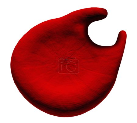 Foto de Ilustración de un glóbulo rojo anormal (eritrocito) conocido como una célula del cuerno, o queratocito. La forma de estos glóbulos rojos anormales surge de la ruptura de una vesícula similar a una ampolla.. - Imagen libre de derechos