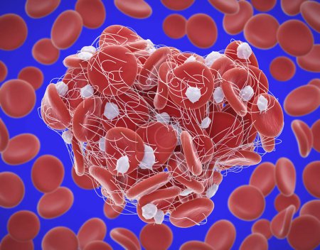 Illustration of red blood cells (erythrocytes) trapped in a fibrin mesh (white) forming a clot. The production of fibrin is triggered by cells called platelets, activated when a blood vessel is damaged. 