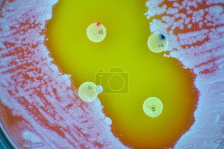 Téléchargez les photos : Vue rapprochée des micro-organismes dans la boîte de Pétri. - en image libre de droit