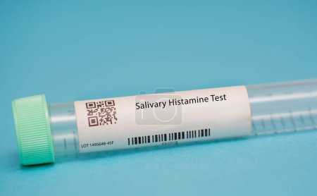 Foto de Prueba de histamina salival. Esta prueba mide los niveles de histamina, una sustancia química que participa en reacciones alérgicas e inflamación, en la saliva.. - Imagen libre de derechos