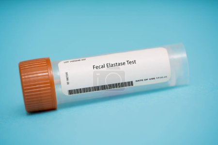 Photo for Faecal elastase test. This test measures the level of elastase, an enzyme produced by the pancreas, in the stool. It can be used to diagnose pancreatic insufficiency, which can lead to malabsorption and malnutrition. - Royalty Free Image