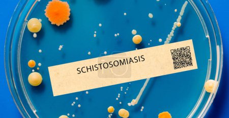 Téléchargez les photos : Schistosomiase. Il s'agit d'une infection parasitaire qui peut causer une maladie chronique et affecte les systèmes urinaire et digestif. - en image libre de droit