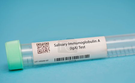 Foto de Prueba de inmunoglobulina salival A (IgA). Esta prueba mide los niveles de iga, un anticuerpo que participa en la respuesta inmunitaria del cuerpo, en la saliva.. - Imagen libre de derechos
