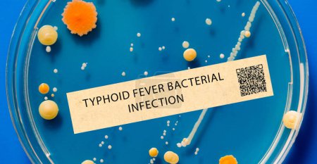 Photo for Typhoid fever. This is a bacterial infection that causes fever, stomach pain, and diarrhoea. - Royalty Free Image