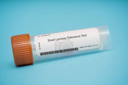 Photo for Stool lactose tolerance test. This test involves consuming a lactose-containing beverage and then measuring the level of lactose and other sugars in the stool over a period of time. It can be used to diagnose lactose intolerance. - Royalty Free Image