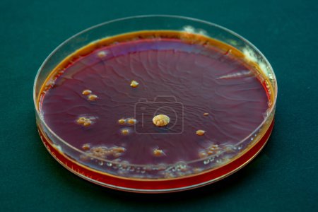 Foto de Vista de cerca de los microorganismos en la placa de Petri. - Imagen libre de derechos