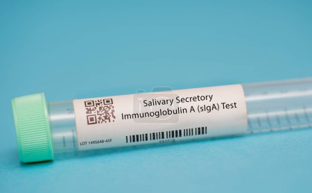 Téléchargez les photos : Test d'immunoglobuline A sécrétoire salivaire (SIGA). Ce test mesure les niveaux de siga, un type d'anticorps présent dans la salive et aide à protéger contre les infections, dans la salive. - en image libre de droit