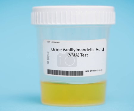 Urin-Vanillylmandelsäure (VMA) -Test. Dieser Test misst die Konzentration von Vma, einem Abbauprodukt bestimmter Hormone, im Urin. Es wird zur Diagnose und Überwachung bestimmter Tumorarten wie Neuroblastom und Phäochromozytom verwendet..