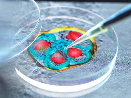 Malaria research, conceptual image. Scientist pipetting a sample into a petri dish with an image of malaria parasites in the background.