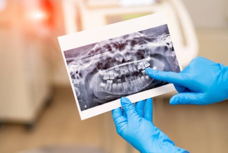 Téléchargez les photos : Traitement orthodontique hospitalier. Examen dentaire des dents. - en image libre de droit