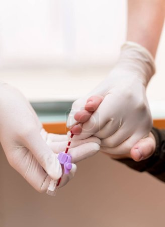 Foto de Hospital blood samples from hand. Blood collecting from finger. - Imagen libre de derechos
