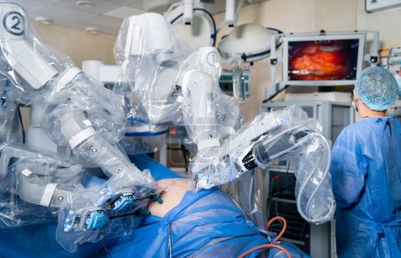 Foto de Proceso de cirugía robótica. Tecnologías de operación modernas. - Imagen libre de derechos