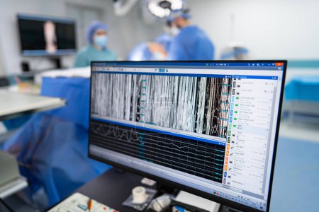 Photo for Computer monitor in the operating room with blurred surgeons and nurses in the background - Royalty Free Image