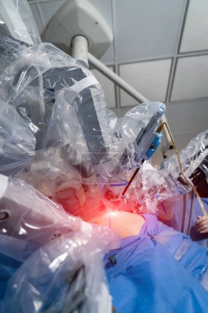 Foto de El paciente está bajo robot quirúrgico durante la cirugía. - Imagen libre de derechos