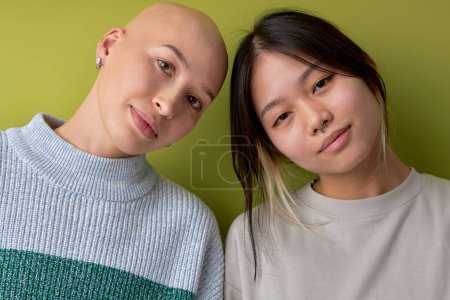 Foto de Two women posing at camera supporting each other, asian and another caucasian bald models, looking at camera smiling. close-up Portrait of ladies in casual outfit having close relationships. alopecia - Imagen libre de derechos