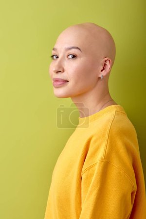 Foto de Portrait of hairless bald caucasian female in yellow shirt posing at camera, side view. attractive european lady looking calm and pretty, beautiful, look at camera. youth, alopecia, oncology, people - Imagen libre de derechos