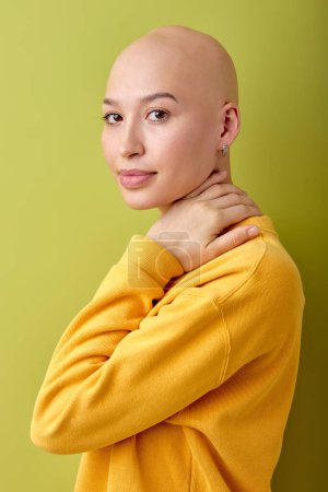 Photo for Pretty bald caucasian woman in yellow shirt standing isolated over green studio background, posing at camera, touching neck. beautiful lady with alopecia or cancer. healthcare concept - Royalty Free Image