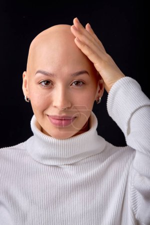 Photo for Close-up portrait of positive smiling bald female in casual wear posing looking at camera. Attractive lady with allopecia or cancer enjoy life, having good mood, no reason to feel bad, touching head - Royalty Free Image