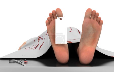 Foto de 3 d ilustración de un cadáver en cama de hospital - Imagen libre de derechos