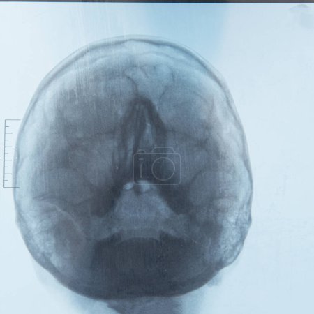 Téléchargez les photos : Cerveau humain sur IRM Scan frontal - en image libre de droit