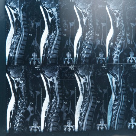 Téléchargez les photos : IRM radiographie des épines sacro-lombaires d'un patient souffrant de maux de dos chroniques - en image libre de droit