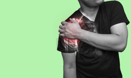 Foto de Primer plano Un hombre sosteniendo su dolor en el hombro lesionado, clavícula rota que está resaltada en rojo. Concepto de atención médica - Imagen libre de derechos