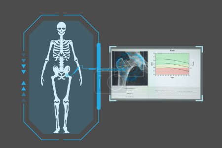 Téléchargez les photos : Examine une plaque holographique numérique technologique représentant le corps du patient, résultats de la densitométrie de la hanche, Concept : Médecine futuriste, Concept de technologie médicale. - en image libre de droit