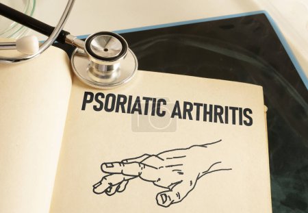 Psoriatic Arthritis is shown using a text