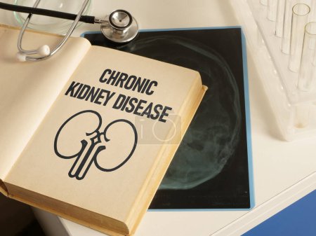 Photo for Chronic kidney disease CKD is shown using a text - Royalty Free Image