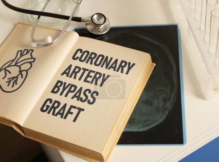 Coronary Artery Bypass Graft CABG wird anhand eines Textes dargestellt