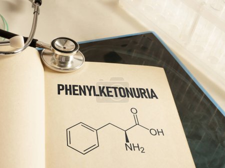 Phenylketonuria is shown using a text on medical photo