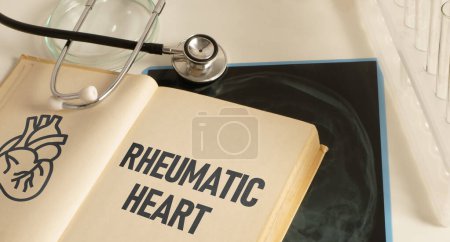 Rheumatic heart is shown using a text