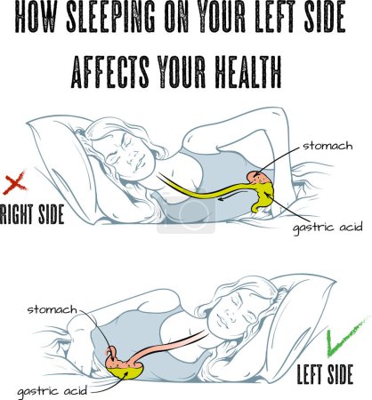 Foto de Ilustración vectorial de los beneficios para la salud de dormir en el lado izquierdo, infografía. - Imagen libre de derechos