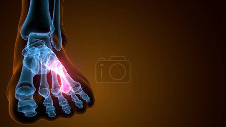 Metatarsal Foot Bones Anatomía médica. Ilustración 3D