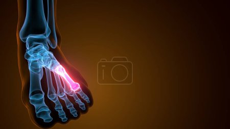 Photo for Metatarsal Foot Bones Anatomy. 3d illustration - Royalty Free Image