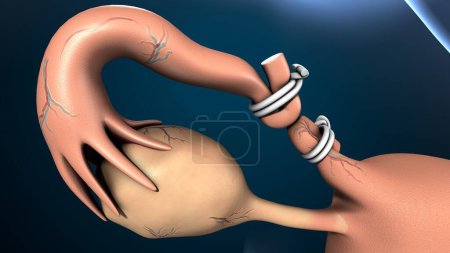 Photo for Female reproductive system anatomy. 3d illustration - Royalty Free Image