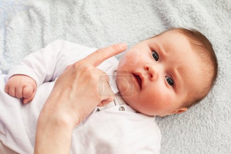 Bebé con dermatitis atópica poniendo crema. Cuidado y prevención del eccema. Evite que su bebé se pique
