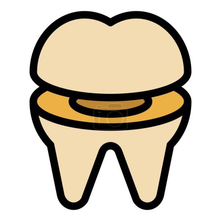 Téléchargez les illustrations : Image vectorielle de contour de l'icône de l'implant dentaire. La dentisterie buccale. Traitement dentaire couleur plat - en licence libre de droit