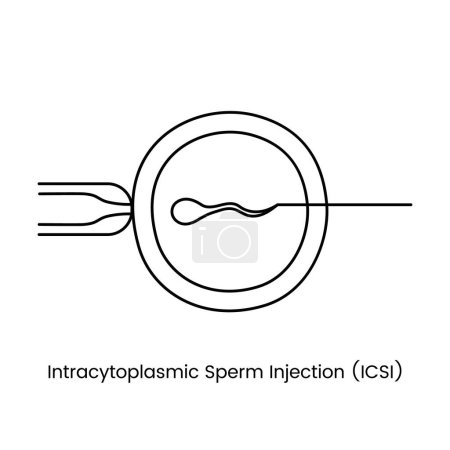Téléchargez les illustrations : Injection intracytoplasmique de sperme, ICSI, icône de ligne dans l'insémination artificielle vectorielle - en licence libre de droit