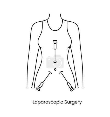Illustration for Laparoscopic surgery icon line in vector, illustration of a medical procedure - Royalty Free Image