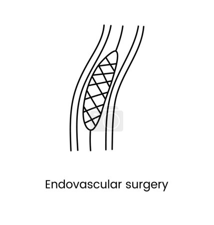 Illustration for Endovascular surgery is an icon line in a vector - Royalty Free Image
