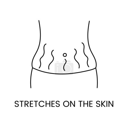 Illustration for Resurfacing stretch marks on the skin with laser cosmetology, line icon in vector body with stretch marks on the abdomen. - Royalty Free Image
