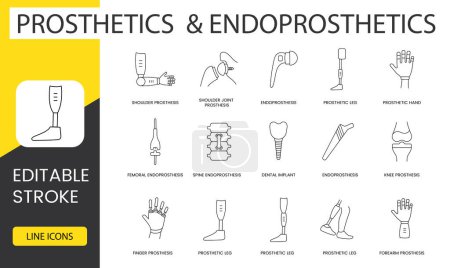 endoprotesis