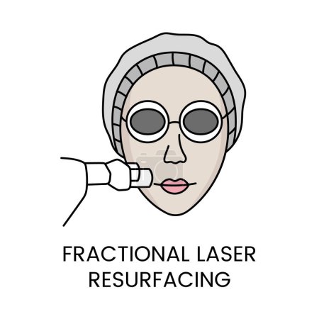 Illustration for Fractional laser rejuvenation in vector woman face with medical equipment. - Royalty Free Image