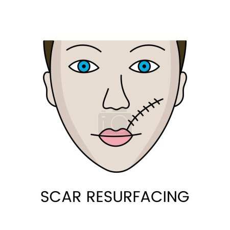 Illustration for Resurfacing, treatment of scars with the help of laser cosmetology, in vector face of a woman with a scar. - Royalty Free Image